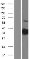 PRPS2 Human Over-expression Lysates NM_002765