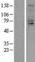Quiescin Q6 (QSOX1) Human Over-expression Lysates NM_002826