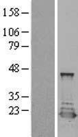 PTS Human Over-expression Lysates NM_000317
