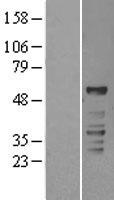 ROR gamma (RORC) Human Over-expression Lysates NM_005060