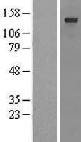 ITPRID2 Human Over-expression Lysates NM_006751