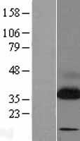 TRAP alpha (SSR1) Human Over-expression Lysates NM_003144