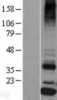 Signal sequence receptor delta (SSR4) Human Over-expression Lysates NM_006280