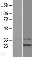 SSX1 Human Over-expression Lysates NM_005635