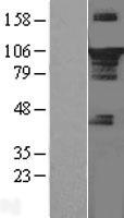 STAT3 Human Over-expression Lysates NM_139276