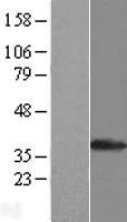SULT1A1 Human Over-expression Lysates NM_001055