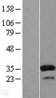 SULT1A1 Human Over-expression Lysates NM_177529