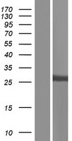 ls006817 sult1a1 human over expression lysates nm 177536 wb testing 5