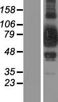 SUPV3L1 Human Over-expression Lysates NM_003171