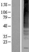 Neurokinin 1 Receptor (TACR1) Human Over-expression Lysates NM_001058