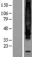 Neurokinin 1 Receptor (TACR1) Human Over-expression Lysates NM_015727