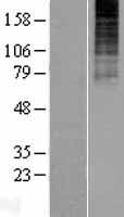 Neurokinin 3 Receptor NK3 (TACR3) Human Over-expression Lysates NM_001059