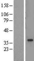 ADA2a (TADA2A) Human Over-expression Lysates NM_133439