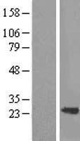 ls006876 sm22 alpha tagln human over expression lysates nm 001001522 wb testing 1