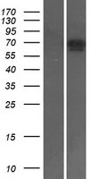 TAK1 (MAP3K7) Human Over-expression Lysates NM_145331