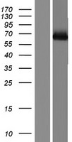 TAK1 (MAP3K7) Human Over-expression Lysates NM_145332