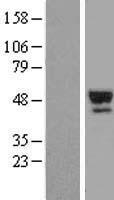 ls006906 thyroxine binding globulin serpina7 human over expression lysates nm 000354 wb testing 1