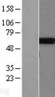 TBXAS1 Human Over-expression Lysates NM_001061