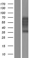 TCF3 / E2A (TCF3) Human Over-expression Lysates NM_001136139