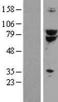 TCF3 / E2A (TCF3) Human Over-expression Lysates NM_003200