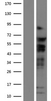 ls006934 tcf7l2 human over expression lysates nm 001146274 wb testing 1