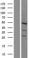 ls006934 tcf7l2 human over expression lysates nm 001146286 wb testing 4