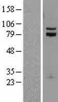 TCF12 Human Over-expression Lysates NM_207036