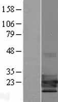 TCF21 Human Over-expression Lysates NM_198392