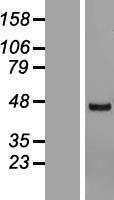 ls006944 yl1 vps72 human over expression lysates nm 005997 wb testing 1