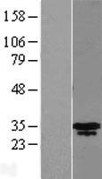 MLX Human Over-expression Lysates NM_198204