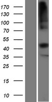 ls006948 tcn2 human over expression lysates nm 001184726 wb testing 1