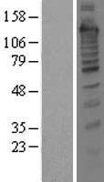 ls006949 treacher collins syndrome protein tcof1 human over expression lysates nm 001008657 wb testing 1