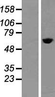 TCP1 alpha (TCP1) Human Over-expression Lysates NM_030752