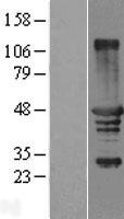 TCP10L3 Human Over-expression Lysates NM_004610