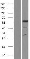TCP11 Human Over-expression Lysates NM_001093728