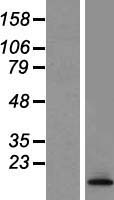 TCTA Human Over-expression Lysates NM_022171