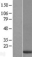 DYNLT3 Human Over-expression Lysates NM_006520