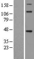 TDO2 Human Over-expression Lysates NM_005651