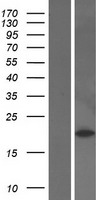 Peroxiredoxin 2 (PRDX2) Human Over-expression Lysates NM_005809