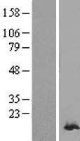 Peroxiredoxin 2 (PRDX2) Human Over-expression Lysates NM_181738