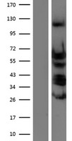 TEAD4 Human Over-expression Lysates NM_003213