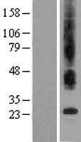 Bax inhibitor 1 (TMBIM6) Human Over-expression Lysates NM_003217