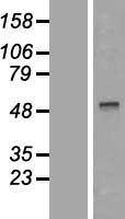 TRF1 (TERF1) Human Over-expression Lysates NM_003218