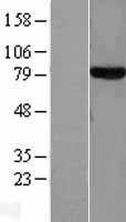 Transferrin (TF) Human Over-expression Lysates NM_001063