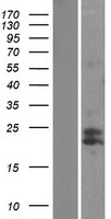 mtTFA (TFAM) Human Over-expression Lysates NM_003201