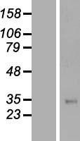 TFPI Human Over-expression Lysates NM_001032281