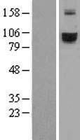 Transferrin Receptor 2 (TFR2) Human Over-expression Lysates NM_003227