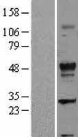 TGF beta 2 (TGFB2) Human Over-expression Lysates NM_003238