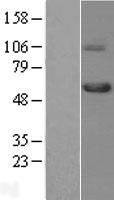 TGF beta Receptor I (TGFBR1) Human Over-expression Lysates NM_004612