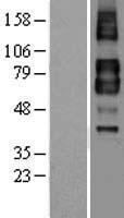 TGF beta Receptor II (TGFBR2) Human Over-expression Lysates NM_003242